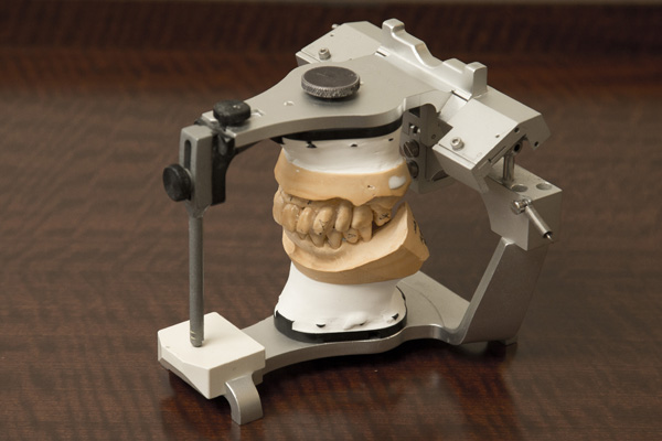 半調節性咬合器