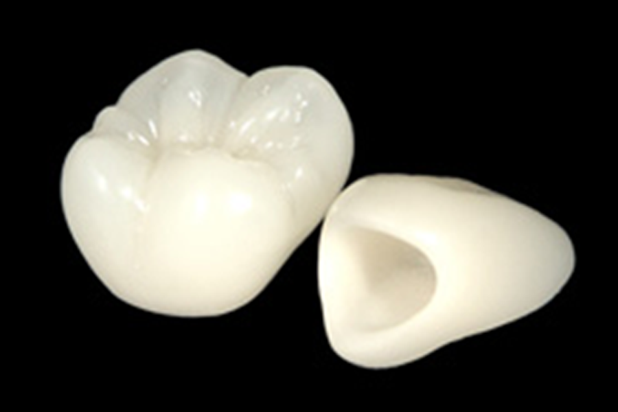 メタルフリー治療