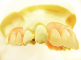 メタルフリー治療