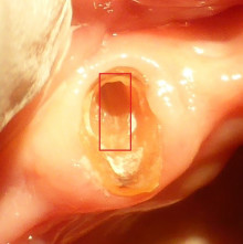 マイクロスコープ