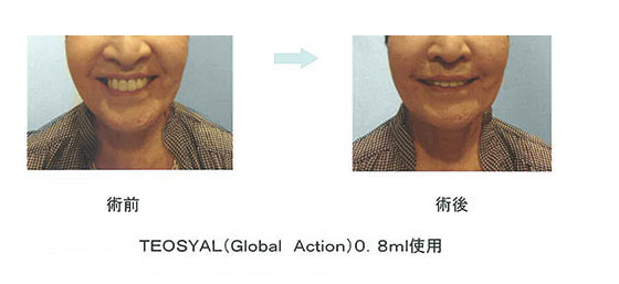 アンチエイジング