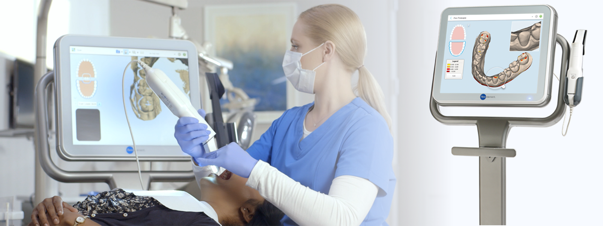 iTero（アイテロ）