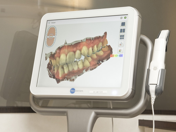 iTero（アイテロ）