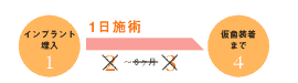 インプラント