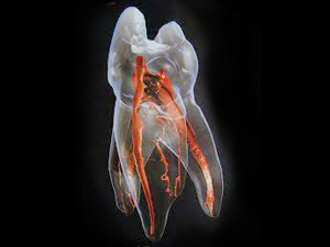 マイクロスコープ