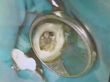 マイクロスコープ