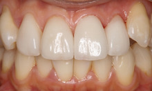 マイクロスコープ