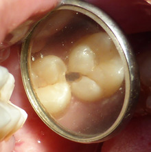 マイクロスコープ