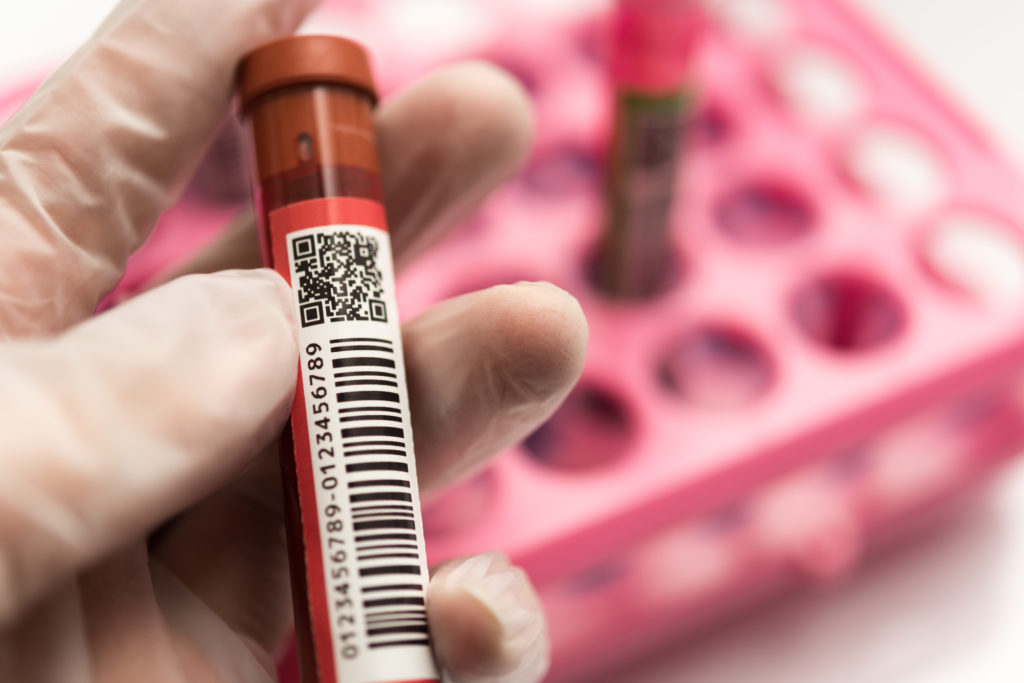 血液オゾン療法