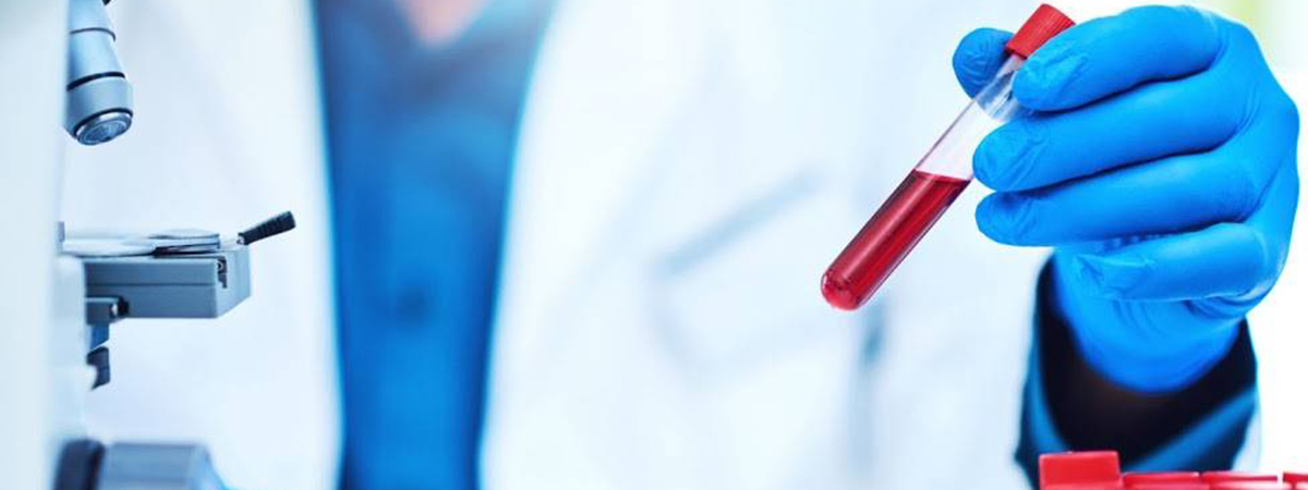 血液オゾン療法