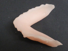 睡眠時無呼吸症候群