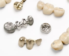 金属アレルギー