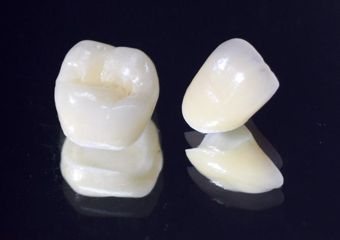 メタルフリー治療